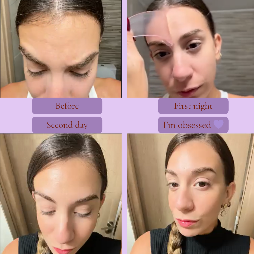 OurPatches™ Forehead Lift Patch – Reusable Silica Gel Pad