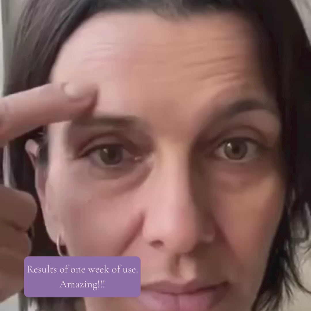OurPatches™ Forehead Lift Patch – Reusable Silica Gel Pad